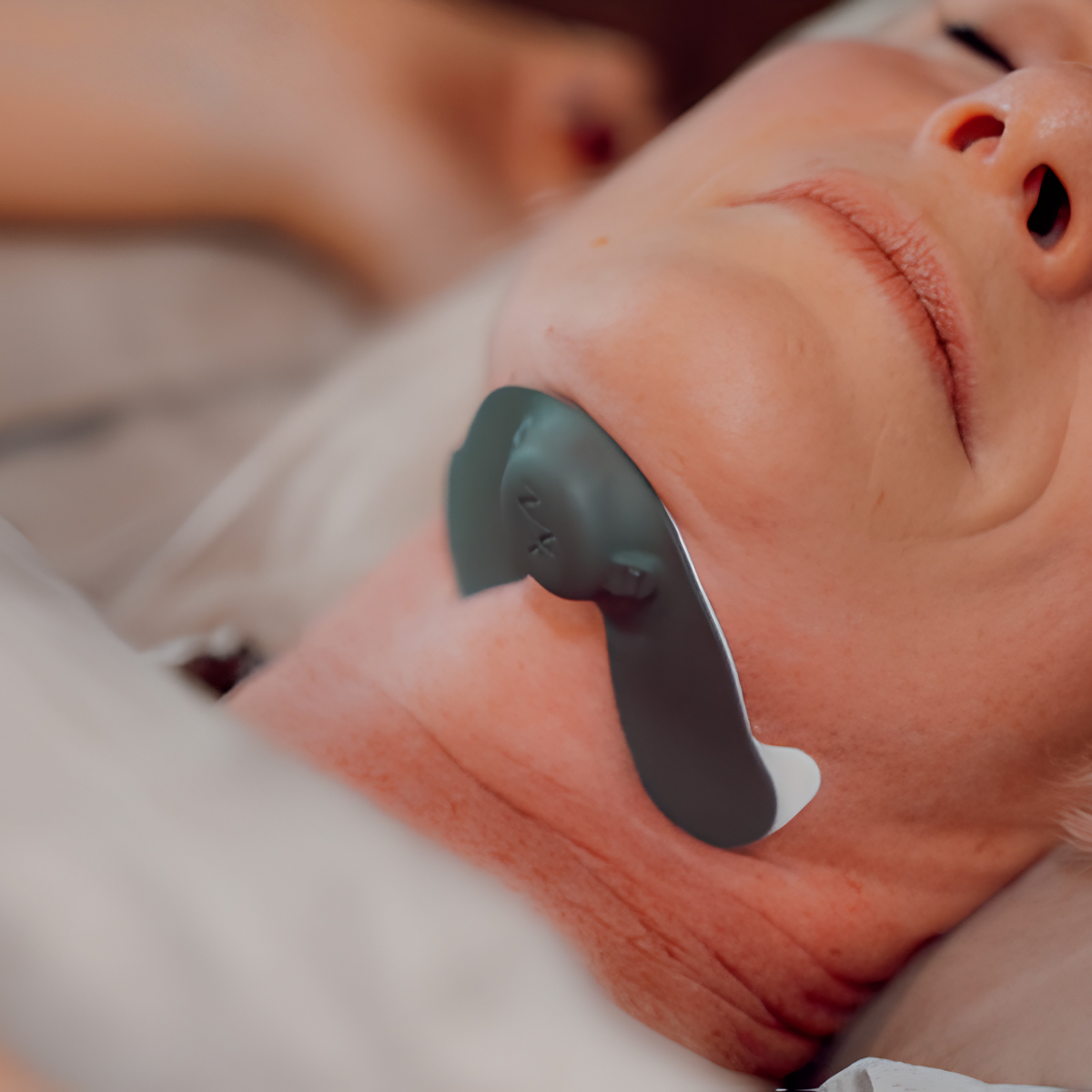 Zeus - Anti-Snoring Device