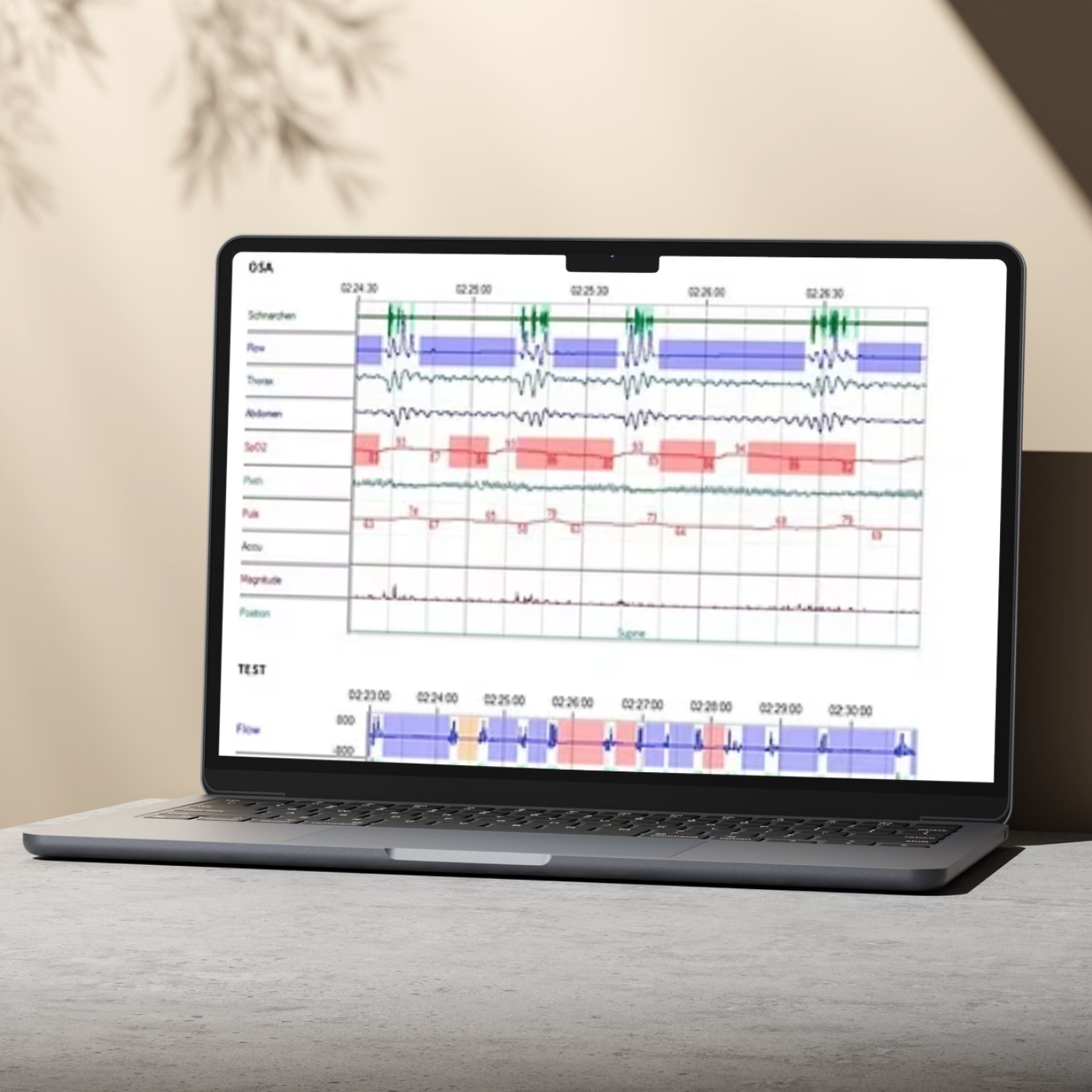 Home Sleep Test with S-Med